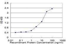 Anti-VDAC1 Mouse Monoclonal Antibody [clone: 4C4]