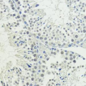 Immunohistochemistry analysis of paraffin-embedded mouse testis using Anti-BAZ2A/TIP5 Antibody (A93167) at a dilution of 1:200 (40X lens). Perform microwave antigen retrieval with 10 mM PBS buffer pH 7.2 before commencing with IHC staining protocol