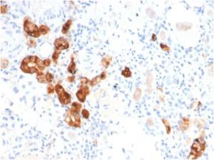 Immunohistochemical analysis of formalin-fixed, paraffin-embedded human kidney using Anti-Calbindin Antibody [CALB1/2782]