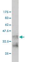 Anti-NRAS Mouse Monoclonal Antibody [clone: 2A3]