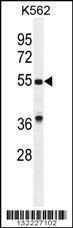 Anti-GDF9 Rabbit Polyclonal Antibody (HRP (Horseradish Peroxidase))