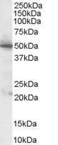 Anti-PDHX Antibody (A83445) (1µg/ml) staining of Human Pancreas lysate (35µg protein in RIPA buffer). Primary incubation was 1 hour. Detected by chemiluminescence.