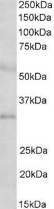 Anti-IGFBP1 Antibody (A85100) (2µg/ml) staining of Human Placenta lysate (35µg protein in RIPA buffer). Primary incubation was 1 hour. Detected by chemiluminescence.