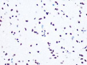 Immunohistochemistry analysis of paraffin-embedded rat brain using Anti-ASH2L Antibody [ARC0326] (A305306) at a dilution of 1:100 (40x lens). Perform microwave antigen retrieval with 10 mM PBS buffer pH 7.2 before commencing with IHC staining protocol.