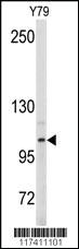 Anti-FUT4 Rabbit Polyclonal Antibody