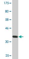 Anti-MBTPS2 Mouse Monoclonal Antibody [clone: 1A3]