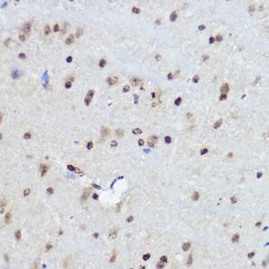 Immunohistochemistry analysis of paraffin-embedded mouse brain using Anti-FANCC Antibody (A8967) at a dilution of 1:100 (40X lens). Perform high pressure antigen retrieval with 10 mM citrate buffer pH 6.0 before commencing with IHC staining protocol