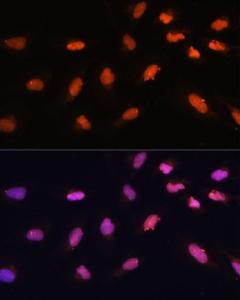 Immunofluorescence analysis of U-2 OS cells using Anti-BAZ2A/TIP5 Antibody (A93167) at a dilution of 1:100. DAPI was used to stain the cell nuclei (blue)