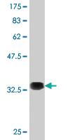 Anti-AMPD2 Mouse Monoclonal Antibody [clone: 2G8]