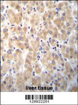 Anti-PABPN1L Rabbit Polyclonal Antibody (FITC (Fluorescein Isothiocyanate))