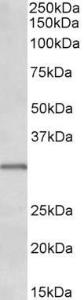 Anti-IGFBP1 Antibody (A85101) (0.1µg/ml) staining of Human Placenta lysate (35µg protein in RIPA buffer). Primary incubation was 1 hour. Detected by chemiluminescence.