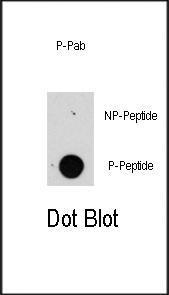 Anti-RPTOR Rabbit Polyclonal Antibody (Biotin)