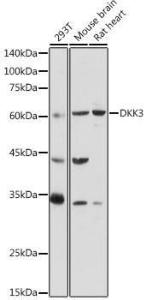 Western blot analysis of extracts of various cell lines, using Anti-Dkk3 Antibody (A93168) at 1:1,000 dilution The secondary antibody was Goat Anti-Rabbit IgG H&L Antibody (HRP) at 1:10,000 dilution Lysates/proteins were present at 25 µg per lane