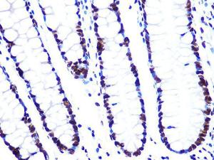 Immunohistochemistry analysis of paraffin-embedded human colon tissue using Anti-ASH2L Antibody [ARC0326] (A305306) at a dilution of 1:100 (40x lens). Perform microwave antigen retrieval with 10 mM PBS buffer pH 7.2 before commencing with IHC staining protocol.