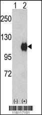 Anti-ENPP2 Rabbit Polyclonal Antibody