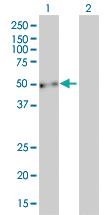 Anti-EVL Mouse Monoclonal Antibody [clone: 5G1]