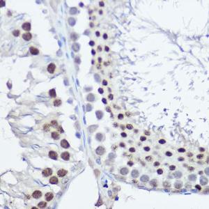 Immunohistochemistry analysis of paraffin-embedded rat testis using Anti-FANCC Antibody (A8967) at a dilution of 1:100 (40X lens). Perform high pressure antigen retrieval with 10 mM citrate buffer pH 6.0 before commencing with IHC staining protocol