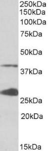 Anti-UROD Antibody (A85102) (0.1 µg/ml) staining of K562 lysate (35 µg protein in RIPA buffer). Primary incubation was 1 hour. Detected by chemilu minescence