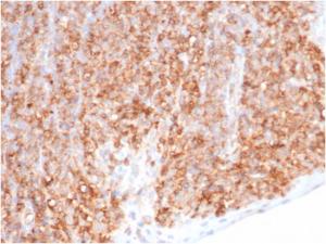 Immunohistochemical analysis of formalin-fixed, paraffin-embedded human tonsil tissue using Anti-HLA G Antibody [HLAG/6686] at 2 µg/ml