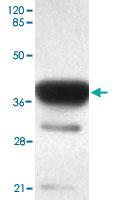 Anti-ACSS1 Mouse Monoclonal Antibody