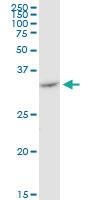 Anti-VDAC2 Mouse Monoclonal Antibody [clone: 3D2]