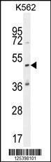 Anti-KATL1 Rabbit Polyclonal Antibody (APC (Allophycocyanin))