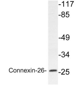 Western blot analysis of lysate from Jurkat cells using Anti-Connexin-26 Antibody