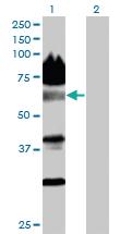 Anti-NACC2 (NACC Family member 2, BEN And BTB (POZ) Domain Containing) Mouse Polyclonal Antibody