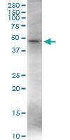 Anti-VDR Polyclonal Antibody Pair