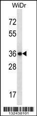 Anti-EAPP Rabbit Polyclonal Antibody