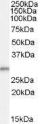 Anti-TPD52L2 Antibody (A83448) (0.1µg/ml) staining of Human Breast Cancer lysate (35µg protein in RIPA buffer). Detected by chemiluminescence.