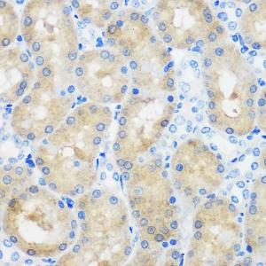 Immunohistochemistry analysis of paraffin-embedded rat kidney using Anti-SPOUT1 Antibody (A306220) at a dilution of 1:100 (40x lens)