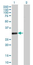 Anti-VDAC2 Mouse Monoclonal Antibody [clone: 3D2]