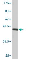 Anti-AMPD2 Mouse Monoclonal Antibody [clone: 2G8]