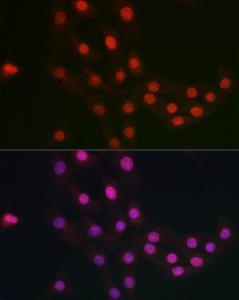 Immunofluorescence analysis of NIH/3T3 cells using Anti-FANCC Antibody (A8967) at a dilution of 1:100. DAPI was used to stain the cell nuclei (blue)