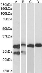 Anti-TNNI3 Antibody (A85104) (0.1µg/ml) staining of adult Mouse (A), fetal Mouse (B), adult Rat (C) and adult Pig (D) Heart lysates (35µg protein in RIPA buffer). Primary incubation was 1 hour. Detected by chemiluminescence.