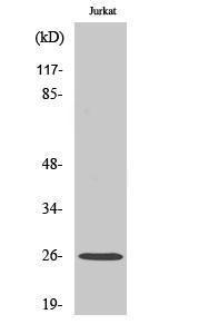 Western blot analysis of various cells using Anti-Connexin-26 Antibody