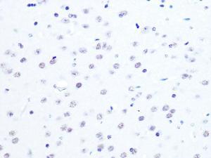 Immunohistochemistry analysis of paraffin-embedded mouse brain using Anti-ASH2L Antibody [ARC0326] (A305306) at a dilution of 1:100 (40x lens). Perform microwave antigen retrieval with 10 mM PBS buffer pH 7.2 before commencing with IHC staining protocol.