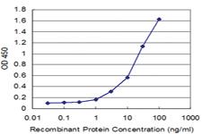 Anti-FTL Mouse Monoclonal Antibody [clone: 2C3]