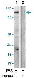 Anti-PRKD1 Rabbit Polyclonal Antibody