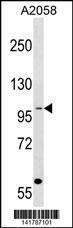 Anti-COPG1 Rabbit Polyclonal Antibody (HRP (Horseradish Peroxidase))