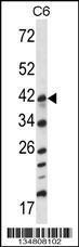 Anti-MAP2K3 Rabbit Polyclonal Antibody (Biotin)