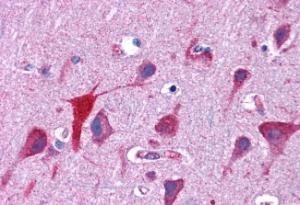 Anti-TPD52L2 Antibody (A83448) (3.75µg/ml) staining of paraffin embedded Human Cortex. Steamed antigen retrieval with citrate buffer pH 6, AP-staining.