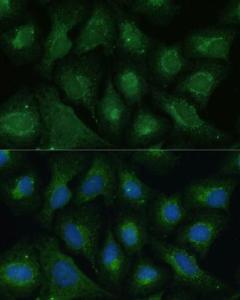 Immunofluorescence analysis of U-2 OS cells using Anti-Dkk3 Antibody (A93168) at a dilution of 1:100 DAPI was used to stain the cell nuclei (blue)