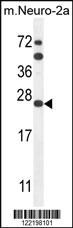 Anti-SCN1B Rabbit Polyclonal Antibody