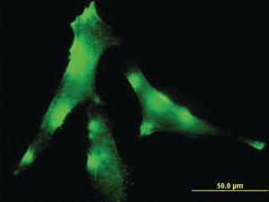 Anti-EVL Mouse Monoclonal Antibody [clone: 5G1]