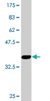 Anti-TFDP2 Mouse Monoclonal Antibody [clone: 2E6]