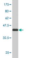 Anti-NCOA4 Mouse Monoclonal Antibody [clone: 1E5]