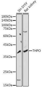 Western blot analysis of extracts of various cell lines, using Anti-Thrombopoietin Antibody (A8968) at 1:1,000 dilution The secondary antibody was Goat Anti-Rabbit IgG H&L Antibody (HRP) at 1:10,000 dilution Lysates/proteins were present at 25 µg per lane