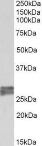 Anti-TNNI3 Antibody (A85104) (0.2µg/ml) staining of Human Heart lysate (35µg protein in RIPA buffer). Primary incubation was 1 hour. Detected by chemiluminescence.